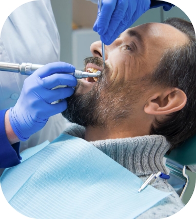 best Dental Implants surgery Warrington