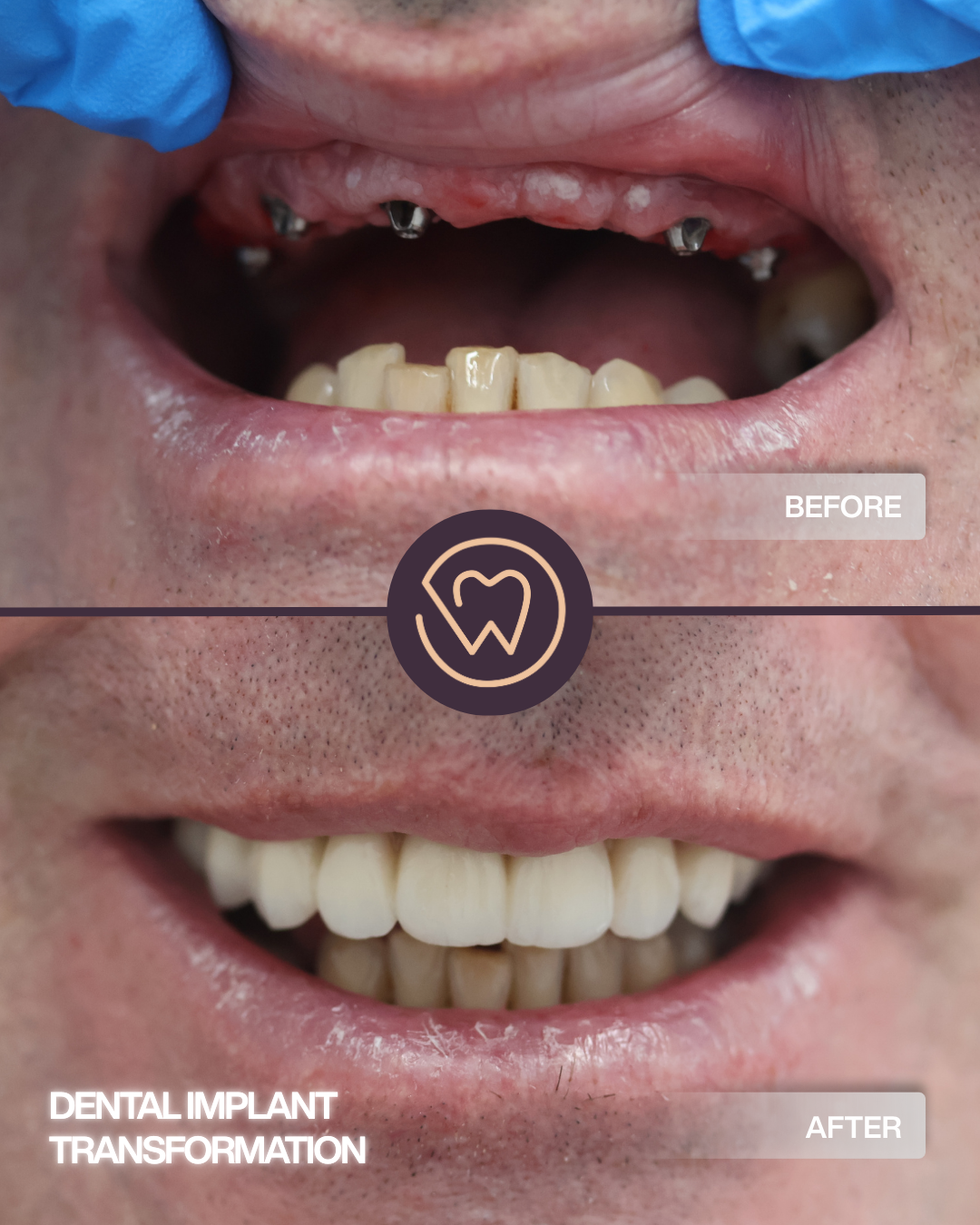 BEFORE AND AFTER (2) copy