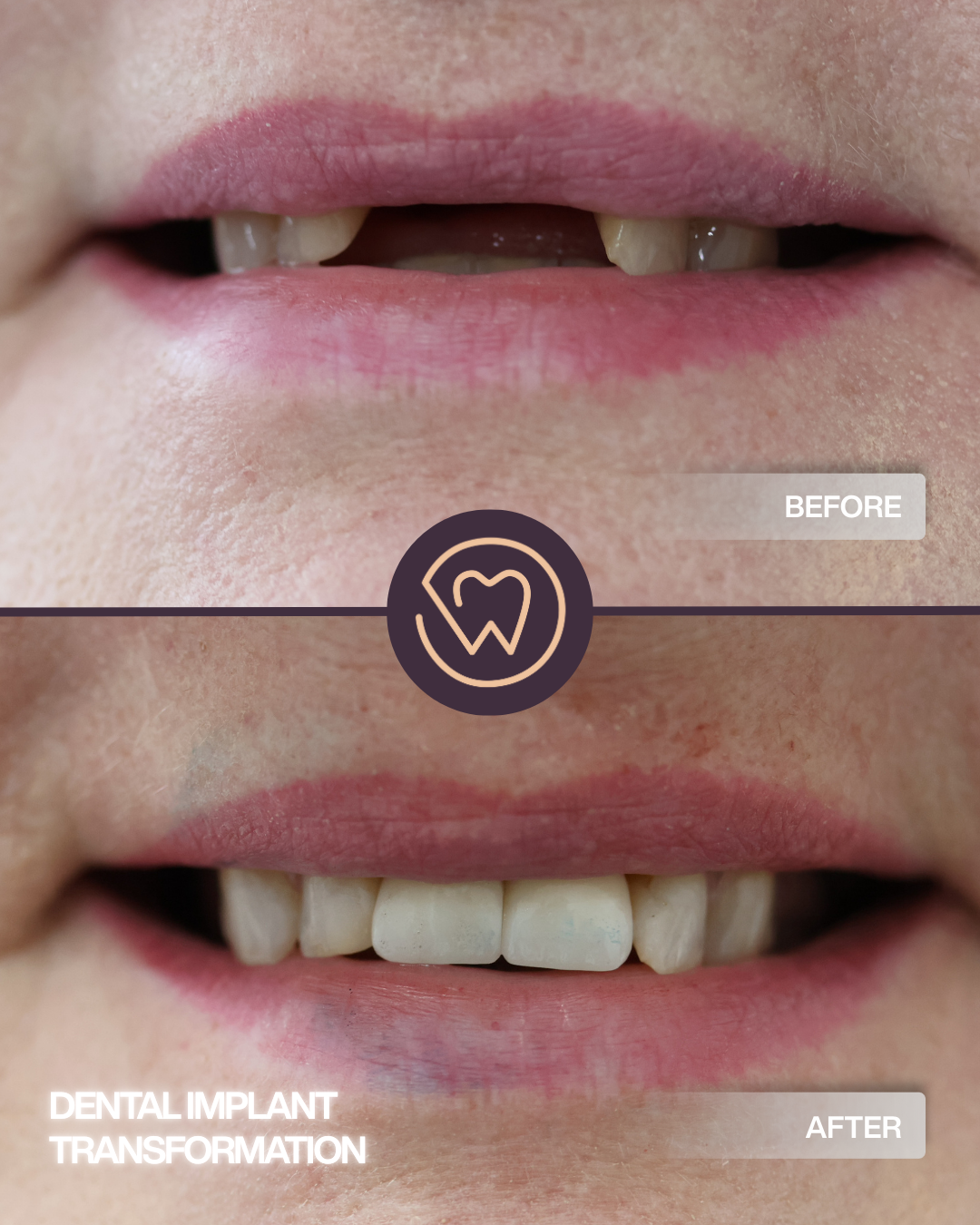 BEFORE AND AFTER (2)