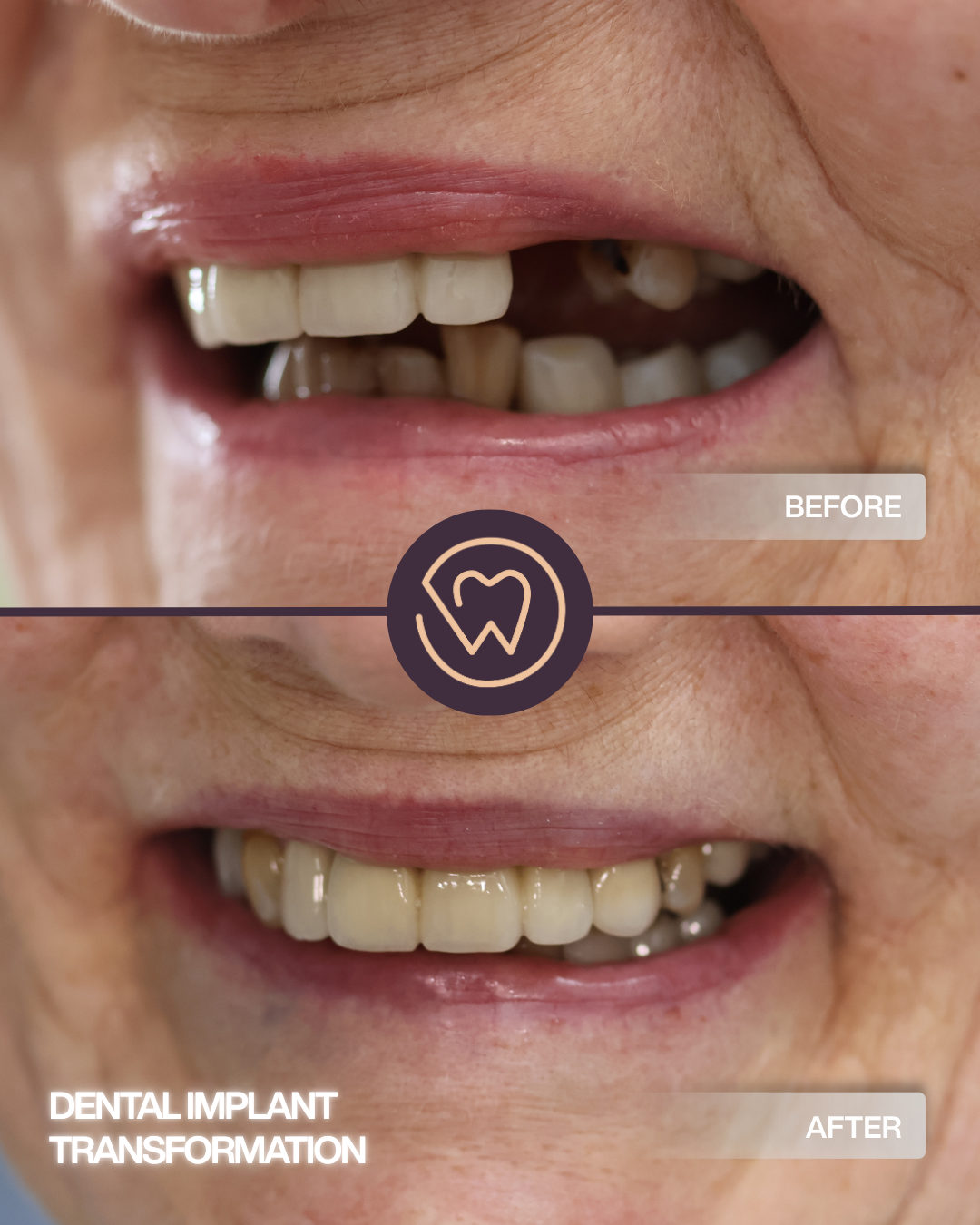 BEFORE AND AFTER (3)