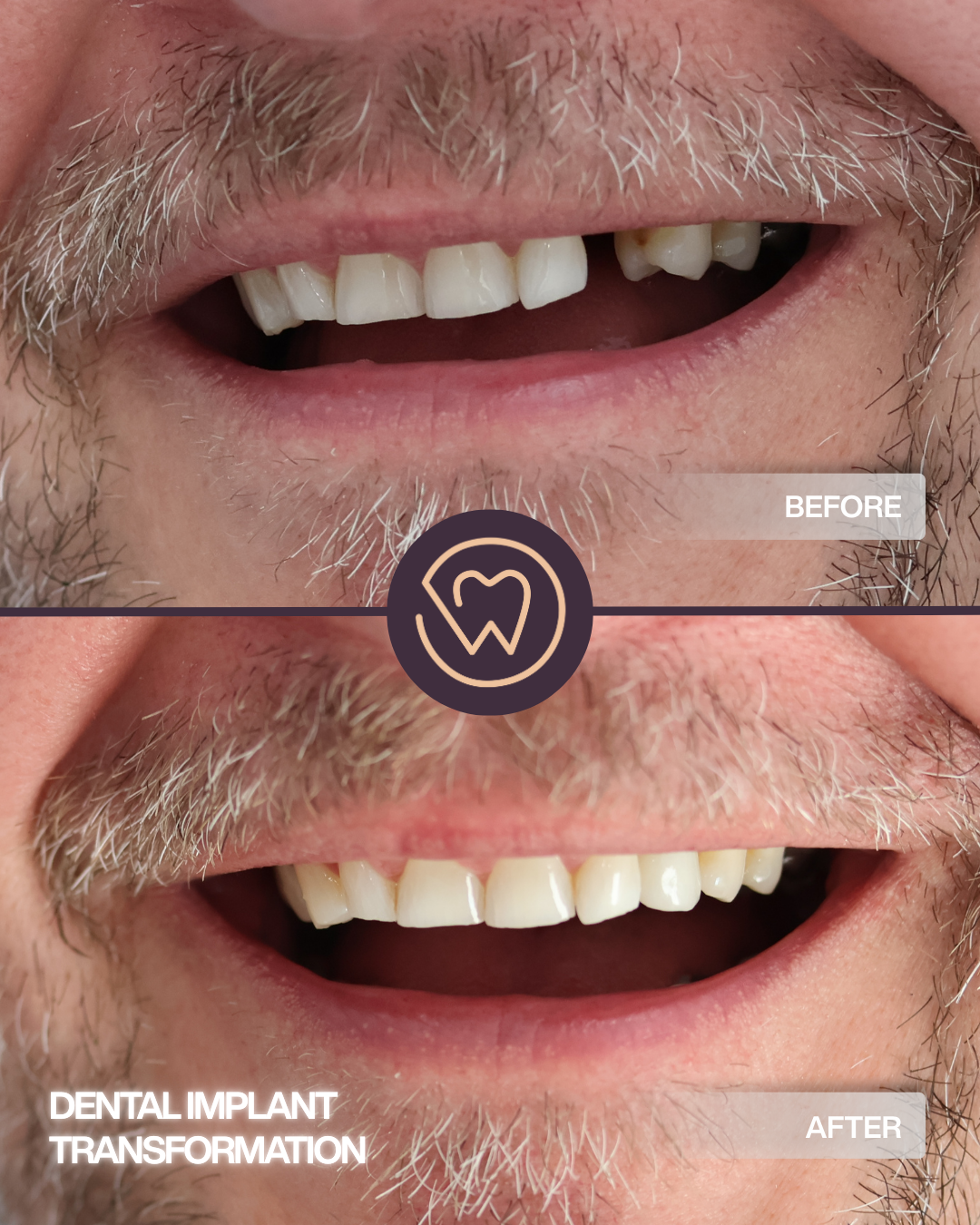 BEFORE AND AFTER (4)